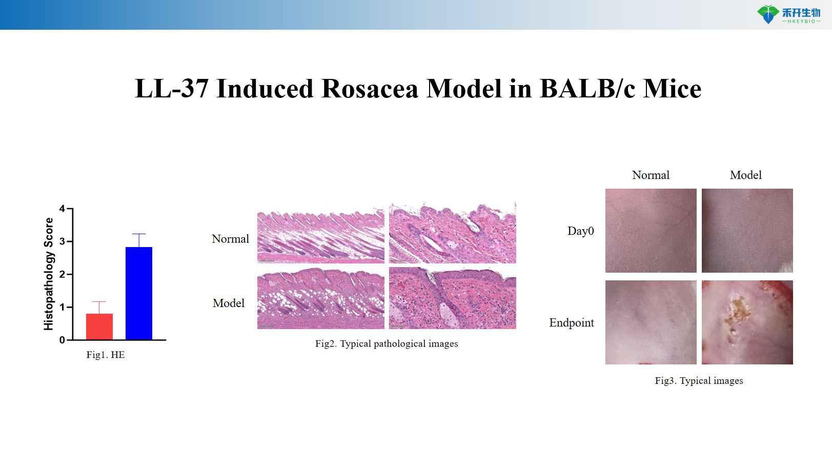 LL-37 Induced Rosacea Model in BALB/c Mice 1