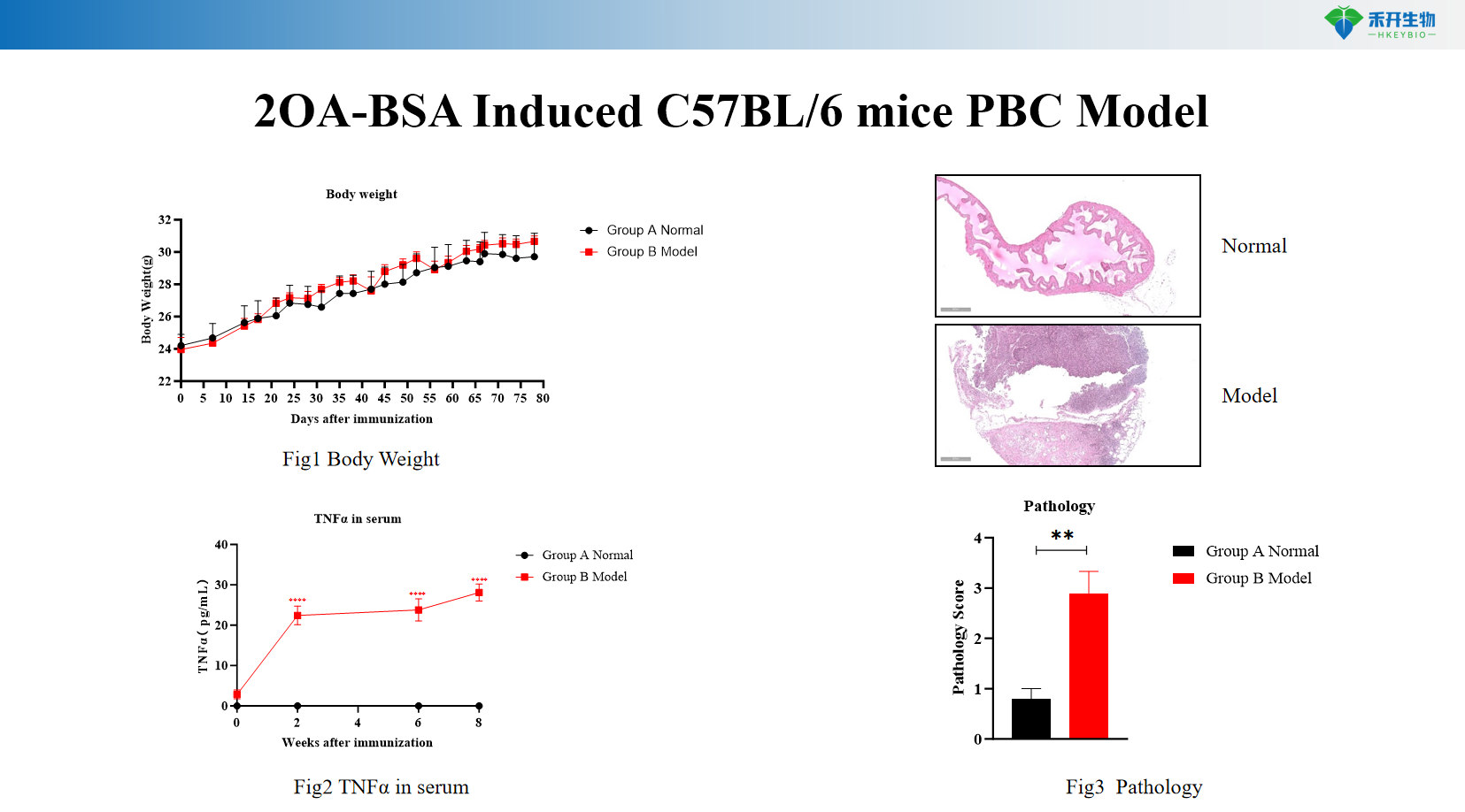 2OA-BSA Induced C57BL/6 mice PBC Model 5f654c9fcfdbe20890854eb818811924
