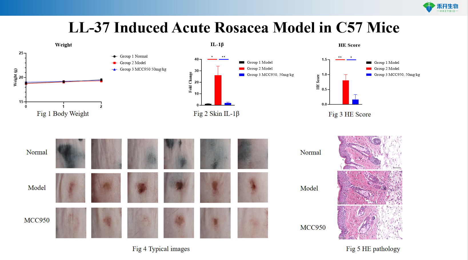 LL-37 Induced Acute Rosacea Model in C57 Mice 2